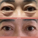 Olivia Quido Skincare Wrinkle Blur Eye Brightener Before and After