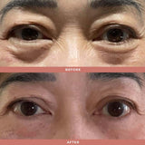 Olivia Quido Skincare Wrinkle Blur Eye Brightener Before and After