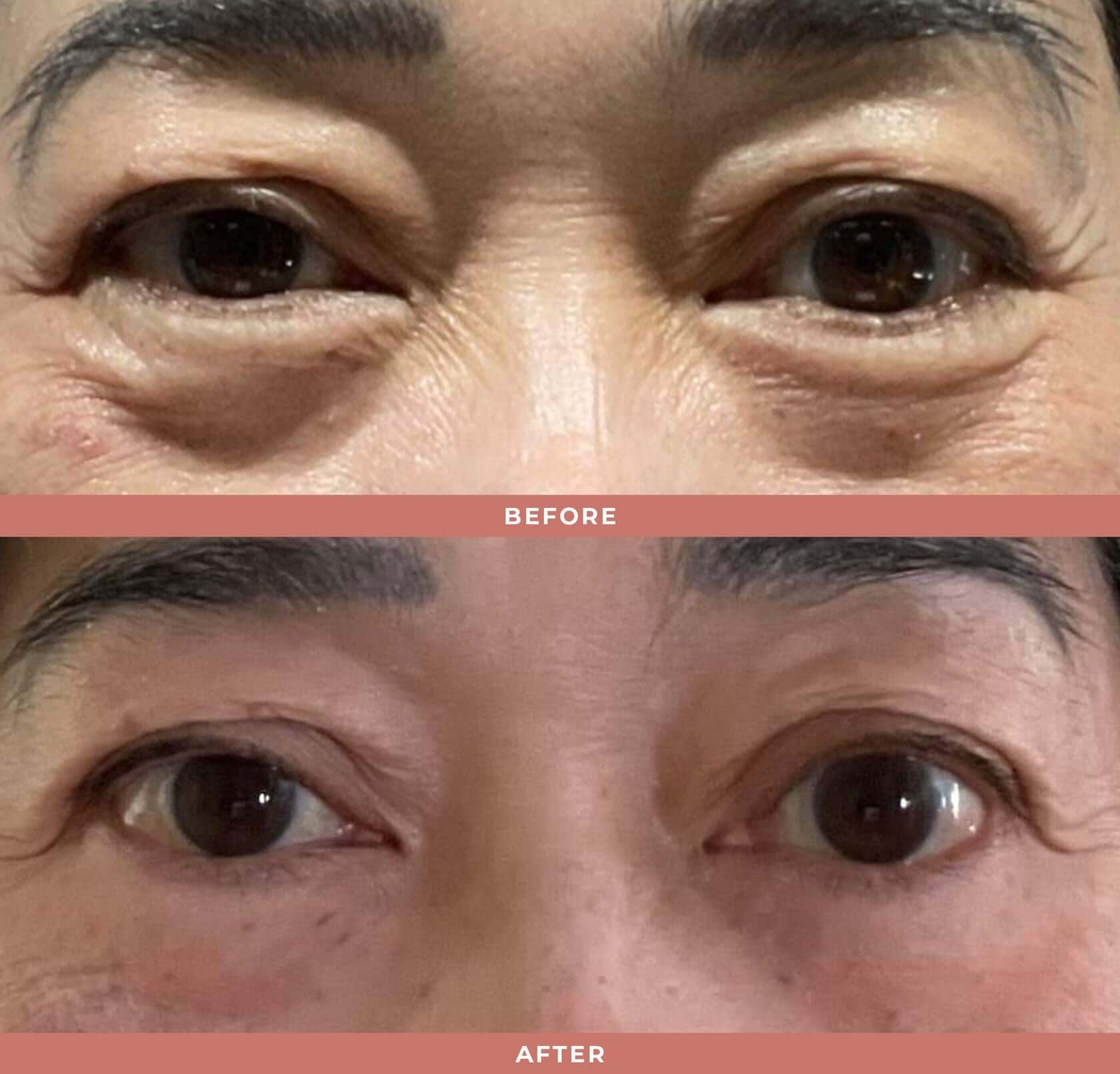 Olivia Quido Skincare Wrinkle Blur Eye Brightener Before and After